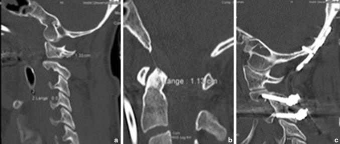Fig. 1