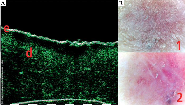 Fig. 9