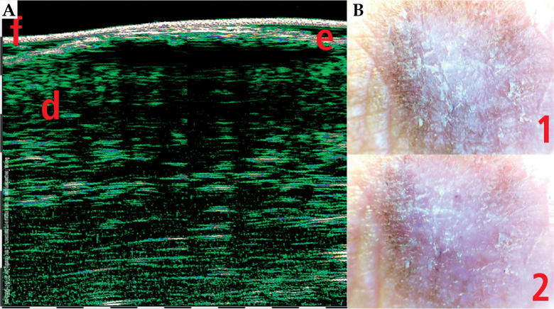 Fig. 11