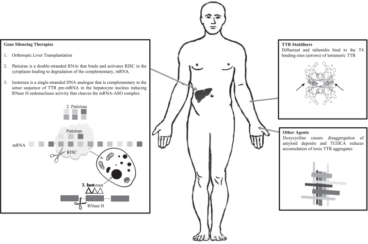 Fig.1