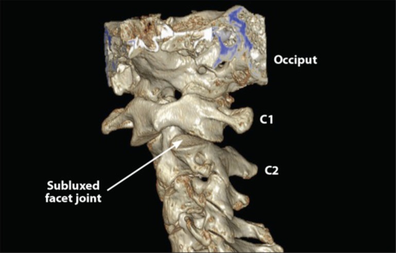 Fig. (5)