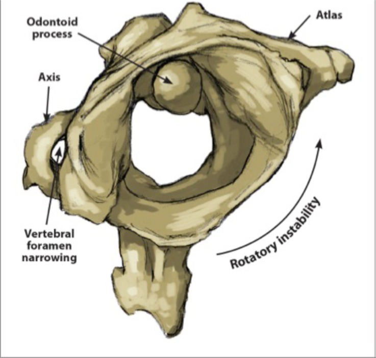 Fig. (1)