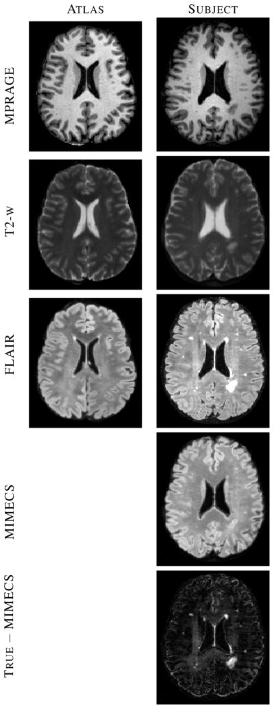 Fig. 11