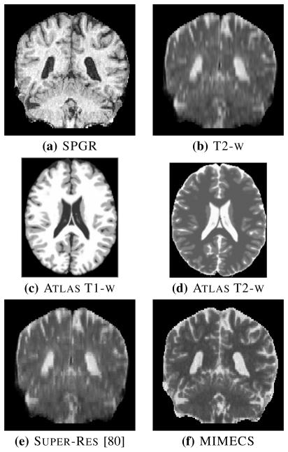 Fig. 9