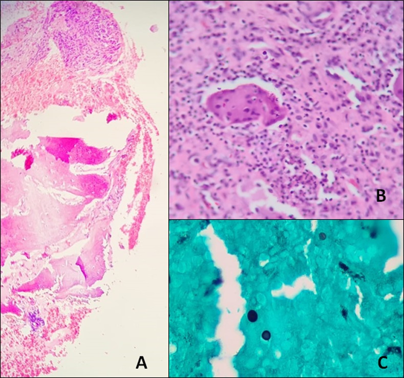 Fig 1