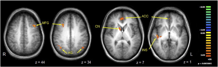 Fig. 1