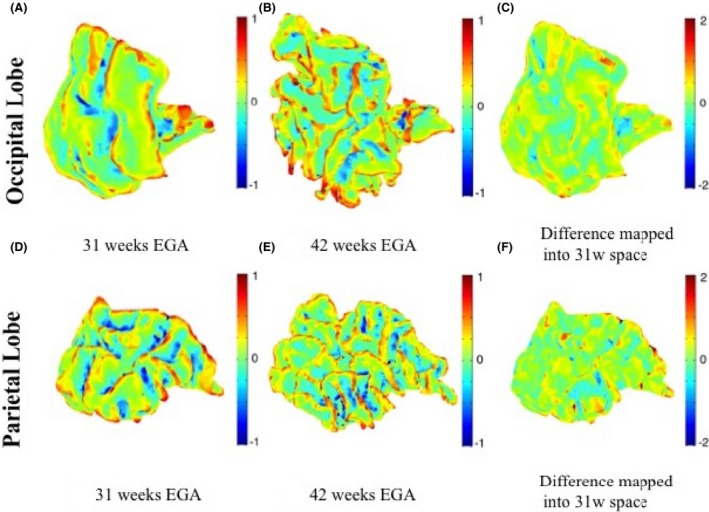 Figure 11