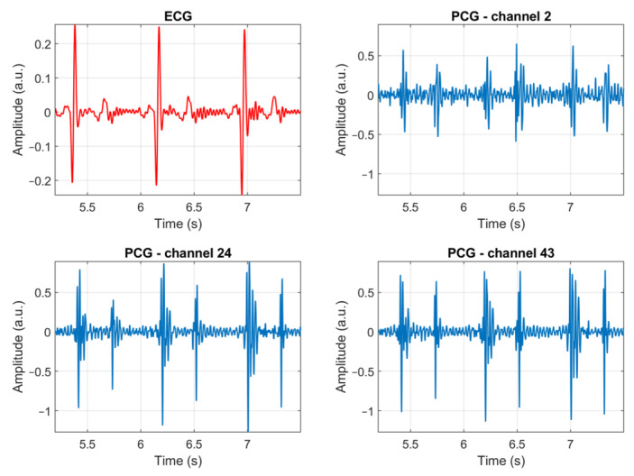 Figure 7