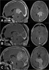 Fig. 3