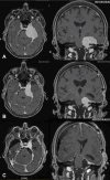 Fig. 6