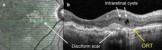 Fig. 4