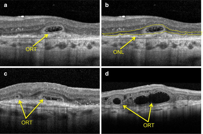 Fig. 1