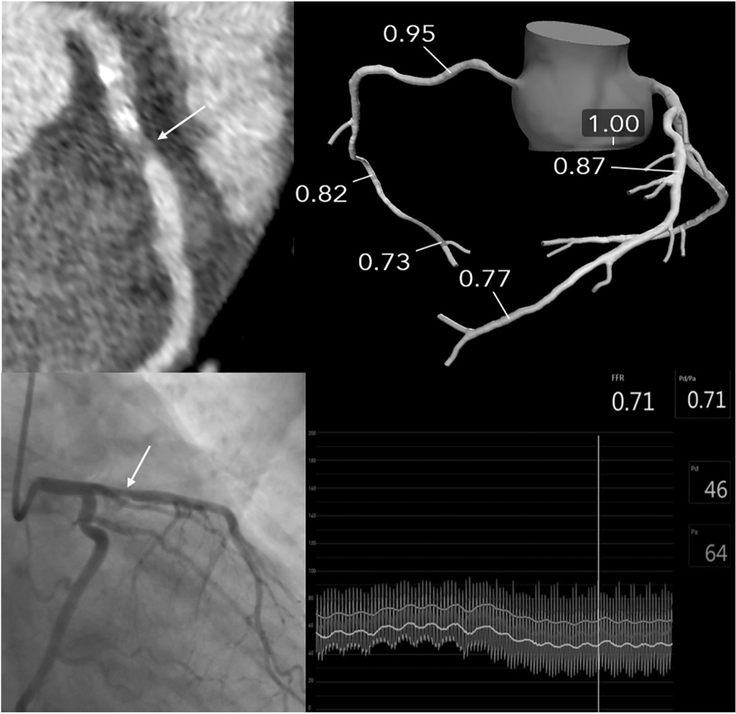 FIG. 4.