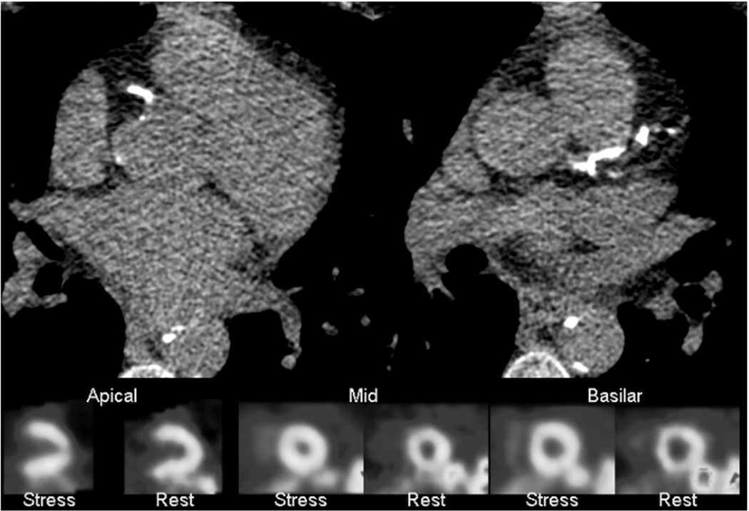 FIG. 5.