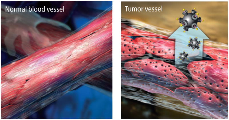 Passive Tumor Targeting