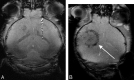 Fig 4.