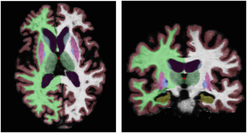 Fig. 2