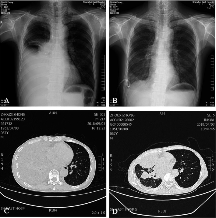 FIGURE 3