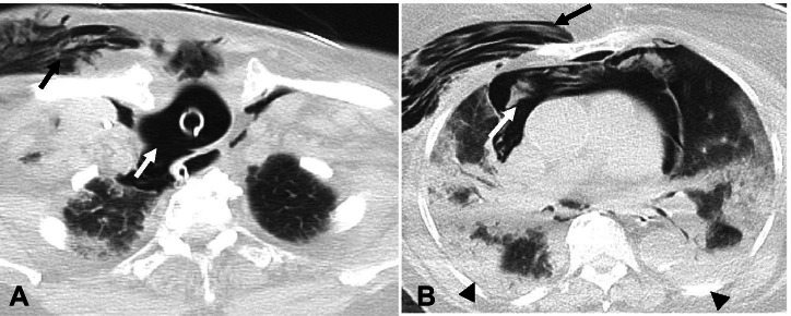 Fig. 13