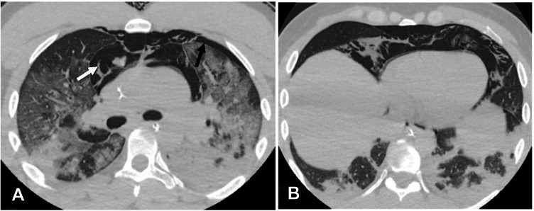 Fig. 10