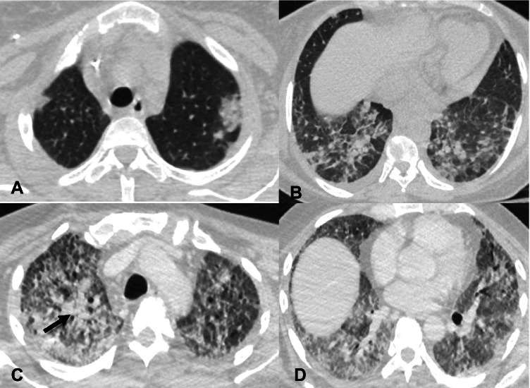 Fig. 12