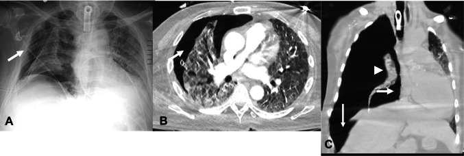 Fig. 11