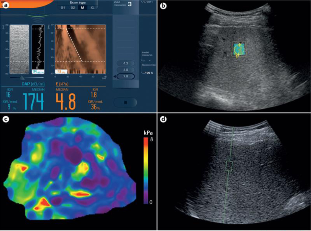 Figure 1 |