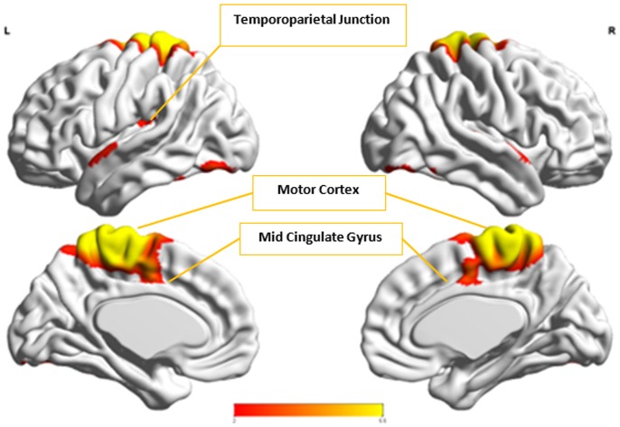 Figure 12