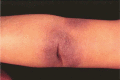 Fig 2.