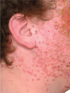 Fig 3.