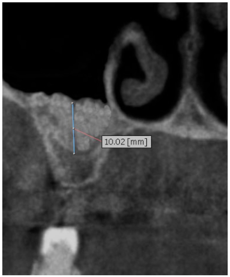 Fig. (6)