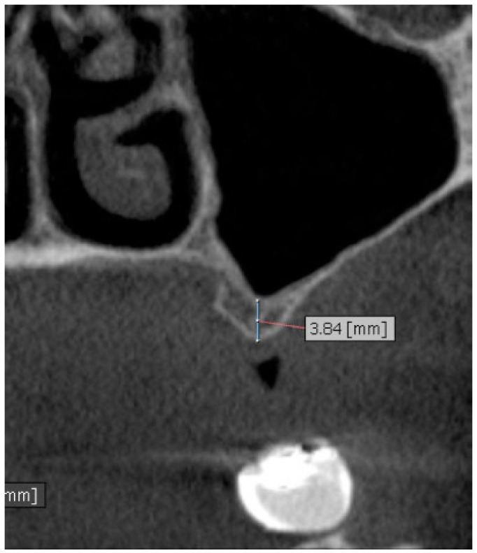 Fig. (7)