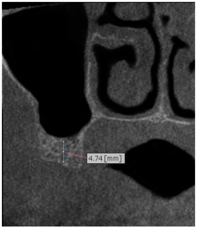 Fig. (5)