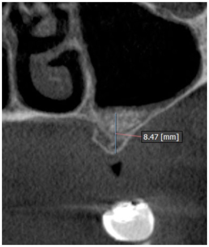 Fig. (8)