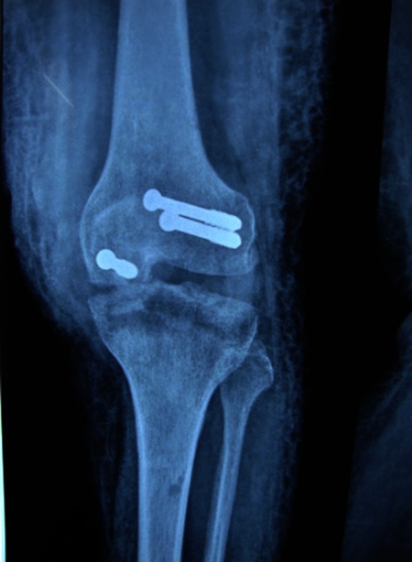 Figure 4