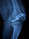 Figure 3