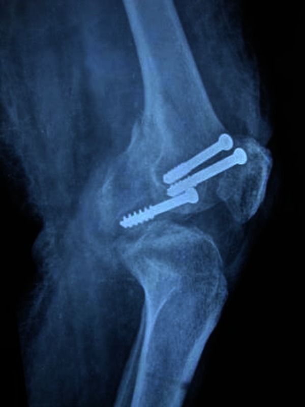 Figure 3
