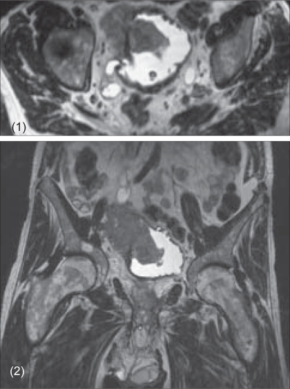 Figures 1 and 2