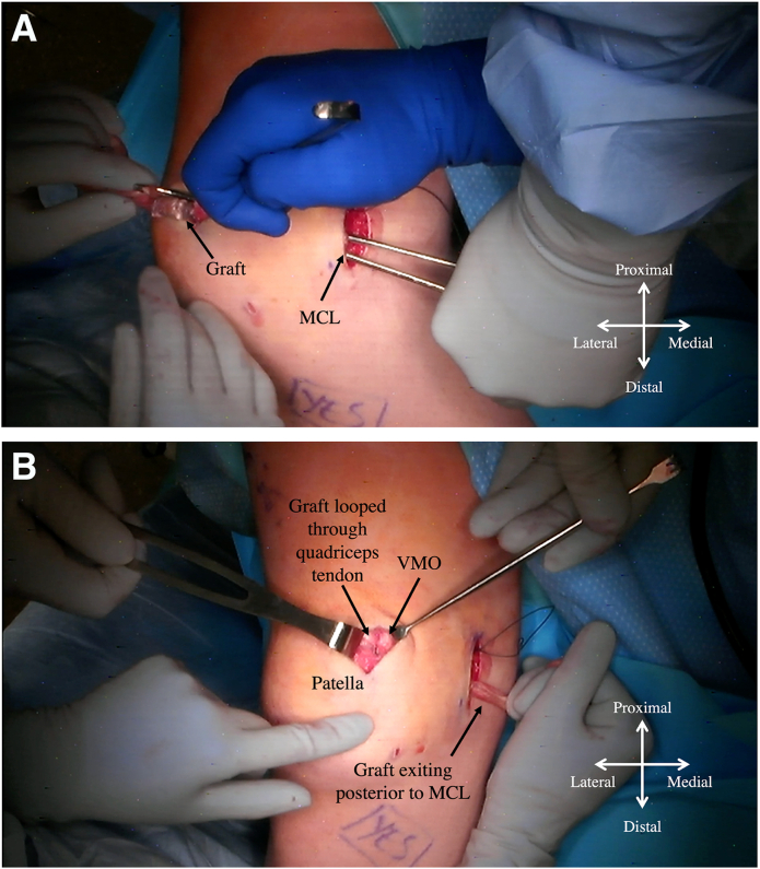 Fig 6