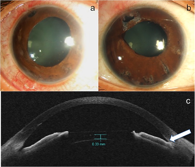 Fig 4