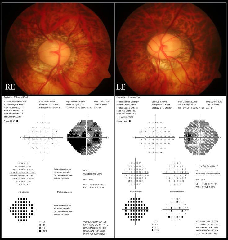 Fig 3