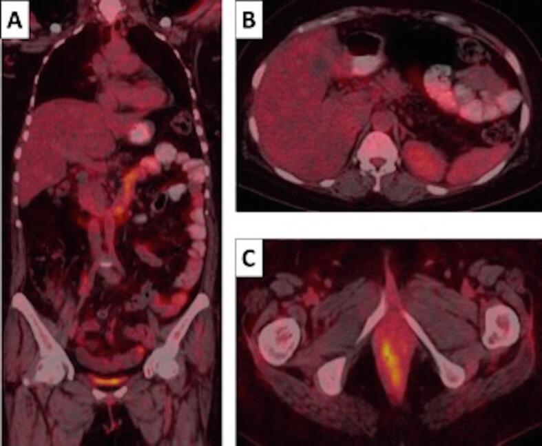 Fig. 2