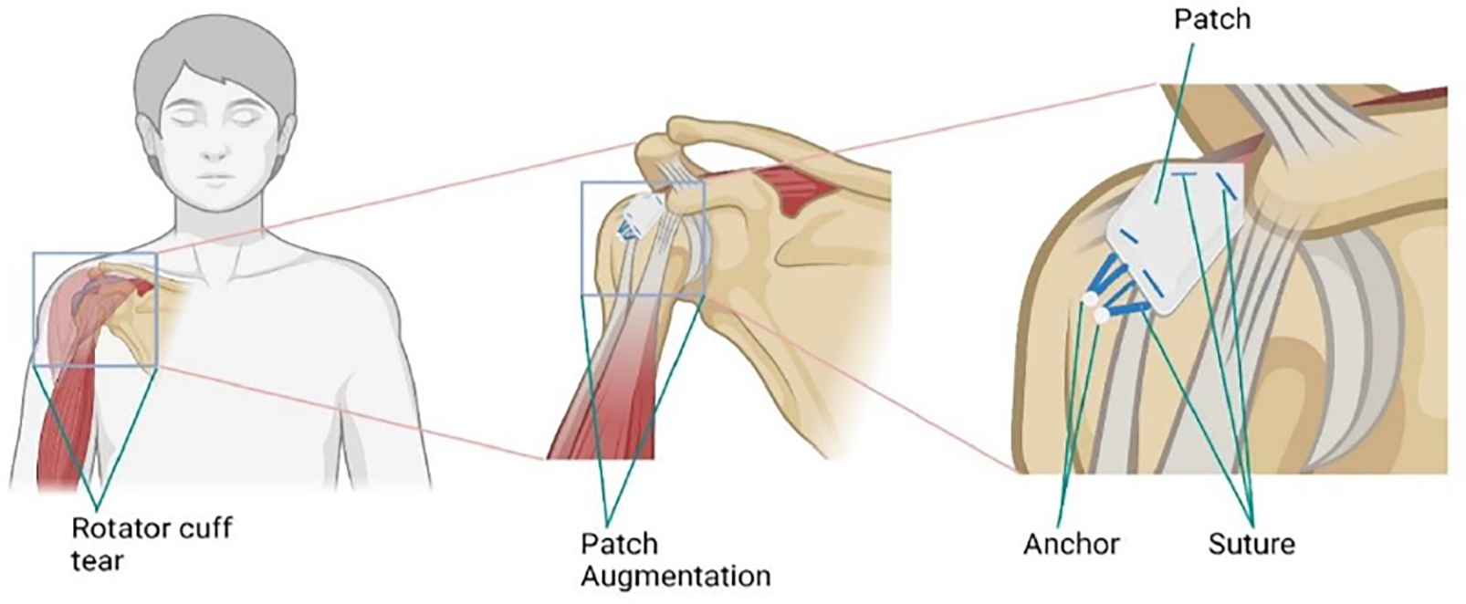 Figure 1: