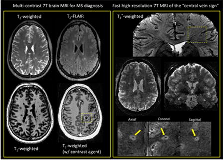 graphic file with name nihms942533u1.jpg