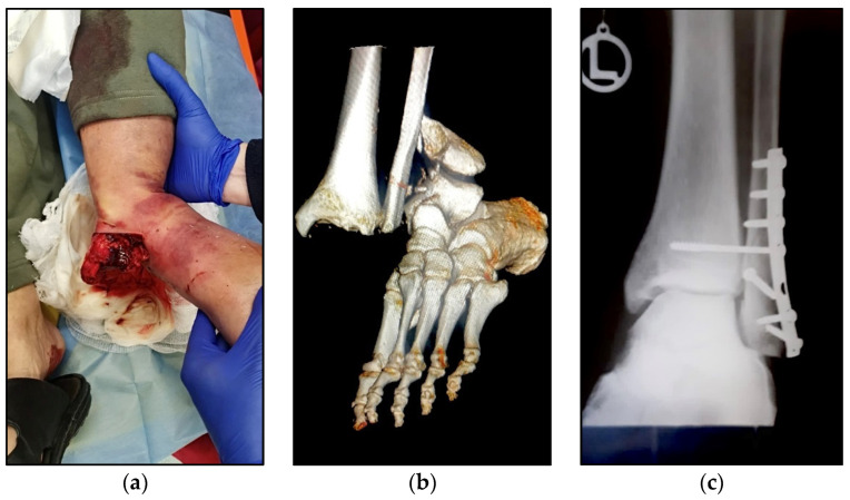 Figure 2