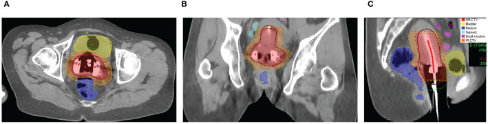 Figure 1