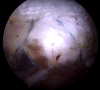 Fig 14