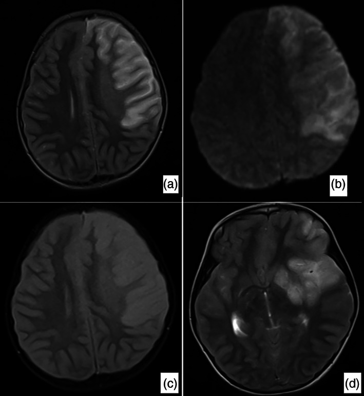 Fig 2