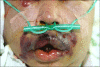 Fig. 1