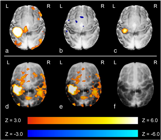 Fig. 4